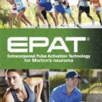 shock wave treatment for mortons neuroma
