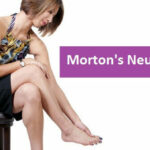 fibromyalgia and foot neuromas