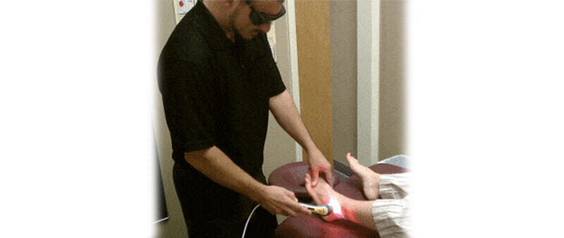 laser therapy for foot neuroma