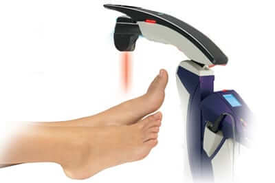 laser treatment for Morton's neuroma