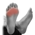 Morton's neuroma pain