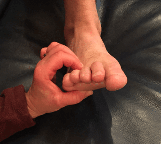 Mortons neuroma test