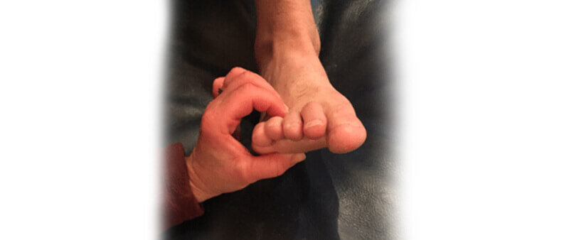 Morton's neuroma test