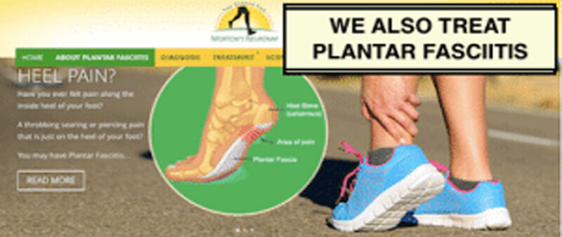 plantar fasciitis