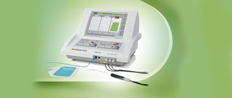 radiofrequency ablation for Morton's neuroma