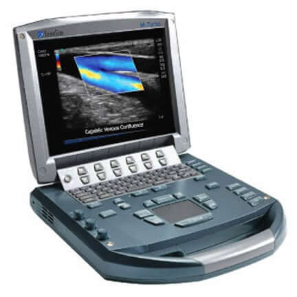 Mortons neuroma ultrasound