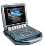 Mortons ultrasound