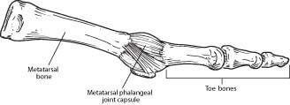 capsulitis