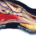fat pad atrophy