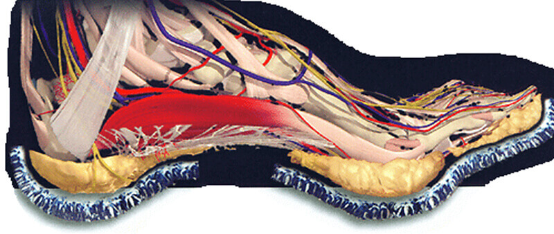 fat pad atrophy